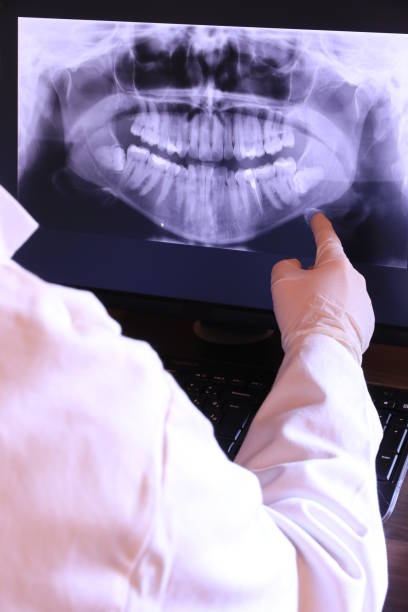 Best Emergency Tooth Extraction in Carencro, LA